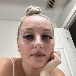 corynmarie