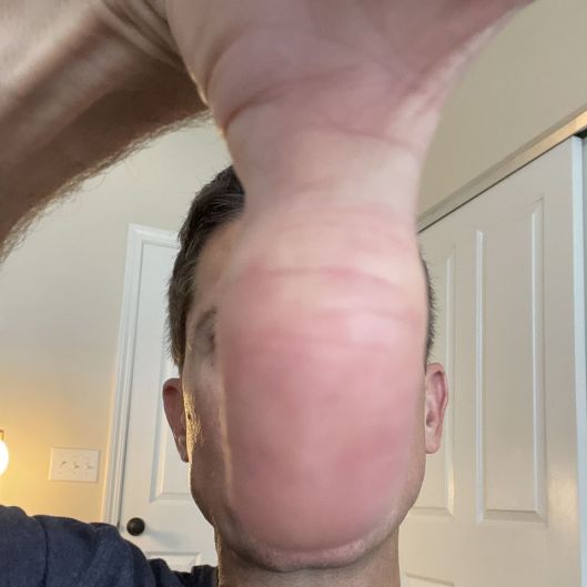 milnermark