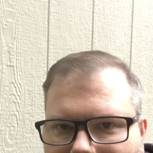 PatrickSD